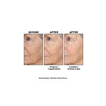 Perlier Black Rice Triple-Size Hyaluronic Acid Gel