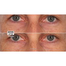 Perlier Black Rice Triple Sized Night Eye Contour Serum