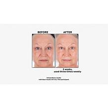 Perlier Bonus Size Royal Elixir Face Mask