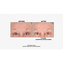 Perlier Honey Royal Jelly Lemon Body Cream and Shower Cream Set