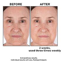 Perlier Jumbo Royal Elixir Face Mask