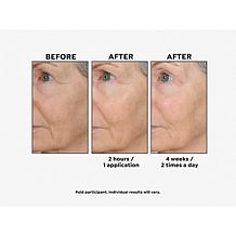 Perlier Megasize Black Rice Hyaluronic Acid Gel