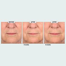 Perlier Royal Elixir Extreme Timecode Serum