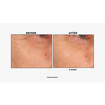 Perlier Royal Elixir Eye Serum Auto-Ship®