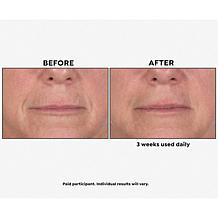 Perlier Royal Elixir Pearls of Youth Alcohol-Free Serum