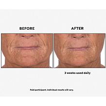 Perlier Supersize Royal Elixir Pearls of Youth Serum Auto-Ship®