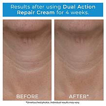 Plexaderm Rapid Reduction Serum 2-pack & Dual Action Cream Auto-Ship®