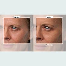 Plexaderm Rapid Reduction Wrinkle Serum 2-pack Auto-Ship®