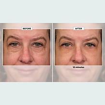 Plexaderm Rapid Reduction Wrinkle Serum 2-pack Auto-Ship®