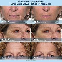 Plexaderm Rapid Reduction Wrinkle Serum 2-pack