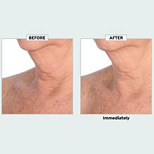 PRAI Beauty AGELESS 3-Pack Throat & Décolletage Hydrogel Masks