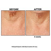 PRAI Beauty Ageless Throat Caviar Overnight Recovery Serum Auto-Ship®