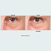 Sharper Image Revel LED Light Therapy Face Mask