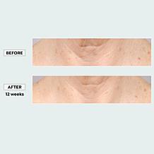 Sharper Image Revel LED Light Therapy Neck & Décolletage Mask