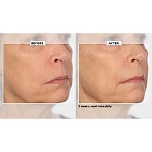 Signature Club A 5 Essentials Cream for Face and Eyes 2-Pack