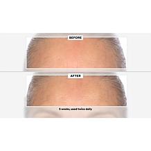 Signature Club A 5 Essentials Cream for Face and Eyes Auto-Ship®