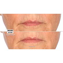 Signature Club A Intensive Lip Fix Cream Auto-Ship®