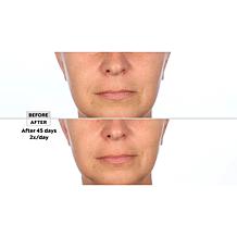 SKINN 3-piece Lab Insider Face Boot Camp Set Auto-Ship®