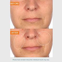 SKINN 3-piece Lab Insider Face Boot Camp Set Auto-Ship®