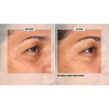 SKINN 30-Day Eye Boot Camp Auto-Ship®