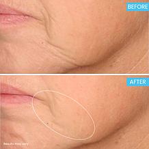 SKINN Age Reset Advanced Night Cream Auto-Ship®