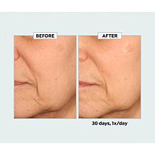 SKINN Age Reset Advanced Night Cream Auto-Ship®