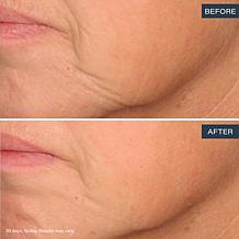 SKINN Age Reset Advanced Night Cream Auto-Ship®