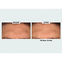 SKINN Age Reset Advanced Night Cream