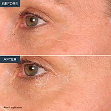 SKINN Age Reset Anhydrous Eye Balm