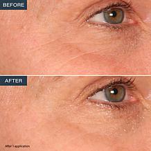 SKINN Age Reset Anhydrous Eye Balm