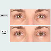 SKINN Age Reset Illuminate Eye Serum- Auto-Ship®