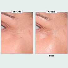 SKINN Age Reset Illuminate Eye Serum
