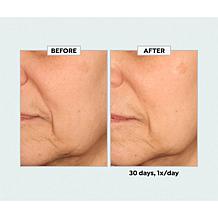 SKINN Age Reset Night Cream + Serum