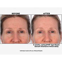 SKINN Age Reset Serum and Headband 2-piece Set