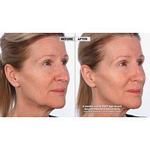 SKINN Age Reset Serum