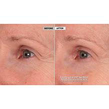 SKINN Age Reset Serum