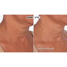 Skinn Cosmetics Neck Amour Defining Serum Auto-Ship®