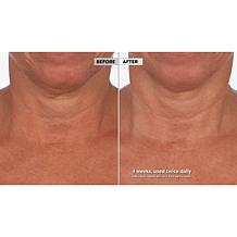 Skinn Cosmetics Neck Amour Defining Serum