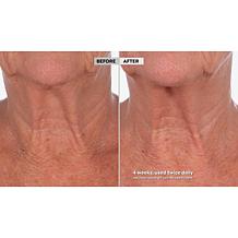 Skinn Cosmetics Neck Amour Redensifying Serum Auto-Ship®