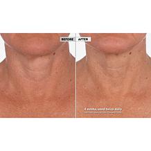 Skinn Cosmetics Neck Amour Redensifying Serum