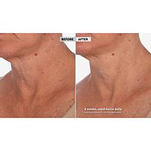 Skinn Cosmetics Neck Amour Redensifying Serum