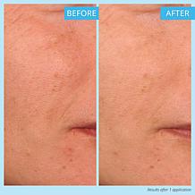 Skinn® Cosmetics Non-Negotiables 2-pack Multi-Acid Resurfacing Pads AS