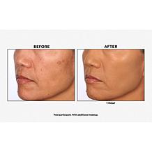 Skinn® Cosmetics Scientific Color Foundation + Concealer