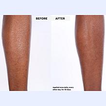 SKINN Dermappeal Body Scrub and Divine Elixir Body Blend AS