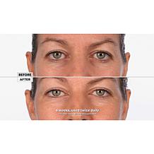 SKINN DWP Eye Creme Reverse Intensive 2-pack Auto-Ship®