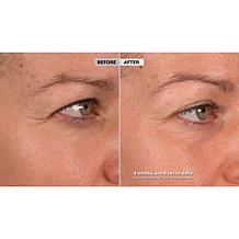 SKINN DWP Eye Creme Reverse Intensive 2-pack