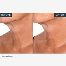 SKINN Neck Amour Advanced Leave-on Mask 1.7 fl. oz. Auto-Ship®