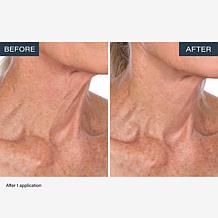 SKINN Neck Amour Advanced Leave-on Mask 1.7 fl. oz.