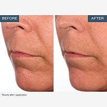 SKINN Non-Negotiables DermAppeal 8 oz. with Scrubbing Tool Auto-Ship®