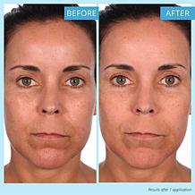SKINN Non-Negotiables DermAppeal & Makeup Removing Cloths
